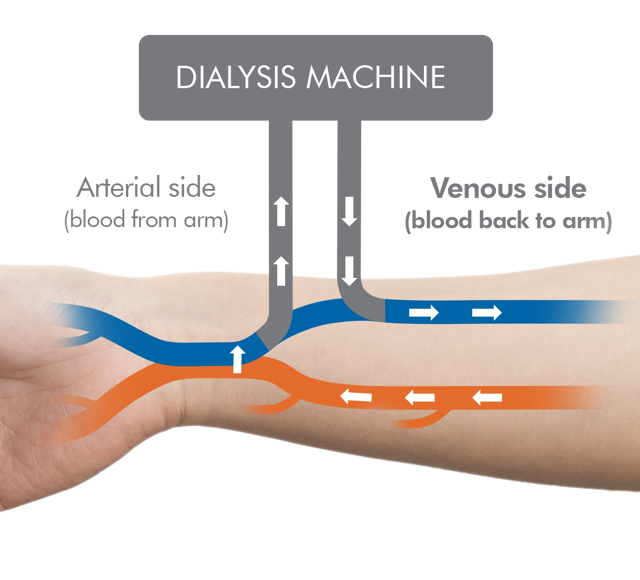 Diagram showing the interaction between patient and the dialysis machine